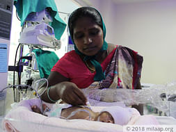 Helpless Mother Is Struggling To Save Premature Baby Born