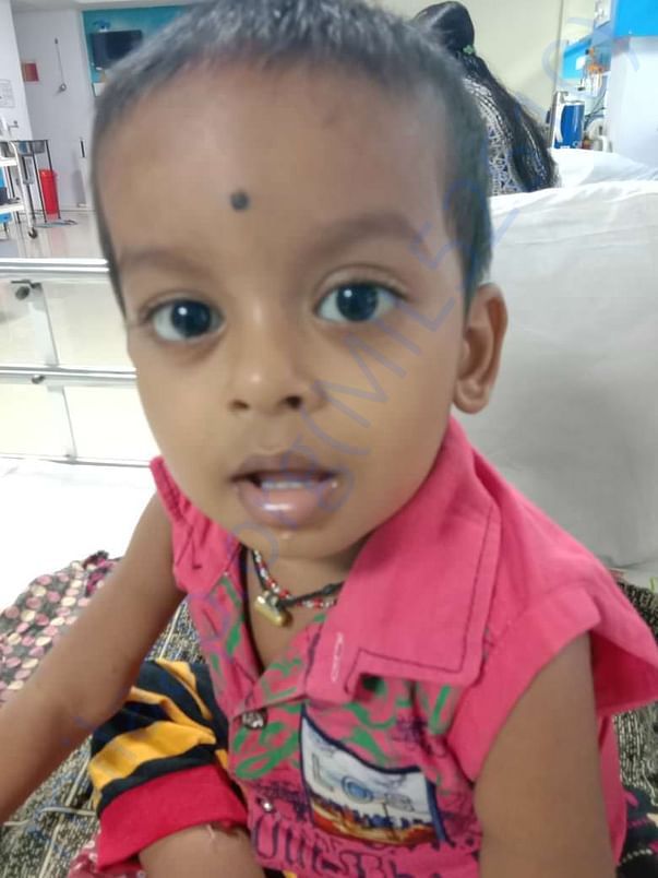 Hospitalized Photo Kmc Atthavara