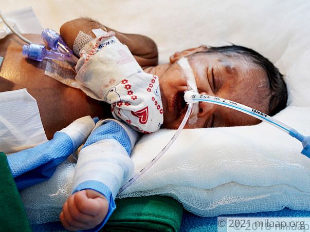 Premature Baby Girl With Underdeveloped Vital Organs Needs Urgent Help