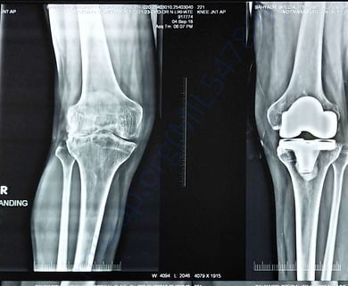 X Ray