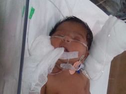 Samuel Health Issue - 4 months 1 day old kid