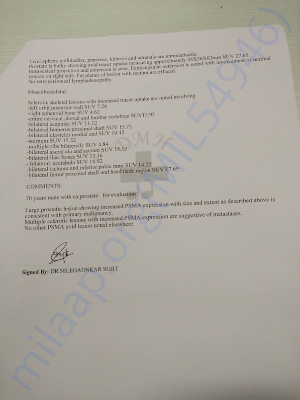 PET SCAN-2