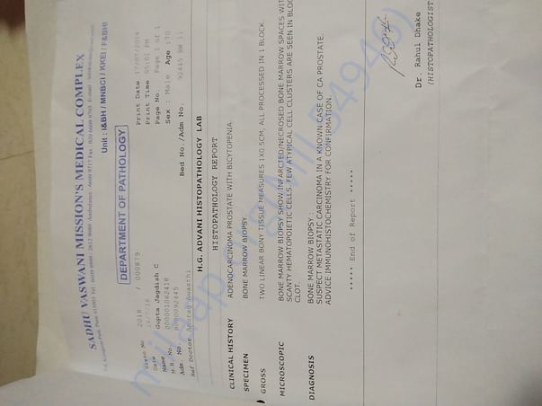 Bone marrow biopsy