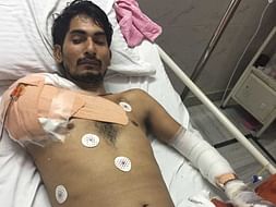 Help Rinku fight Third degree fatal burns and multiple surgeries