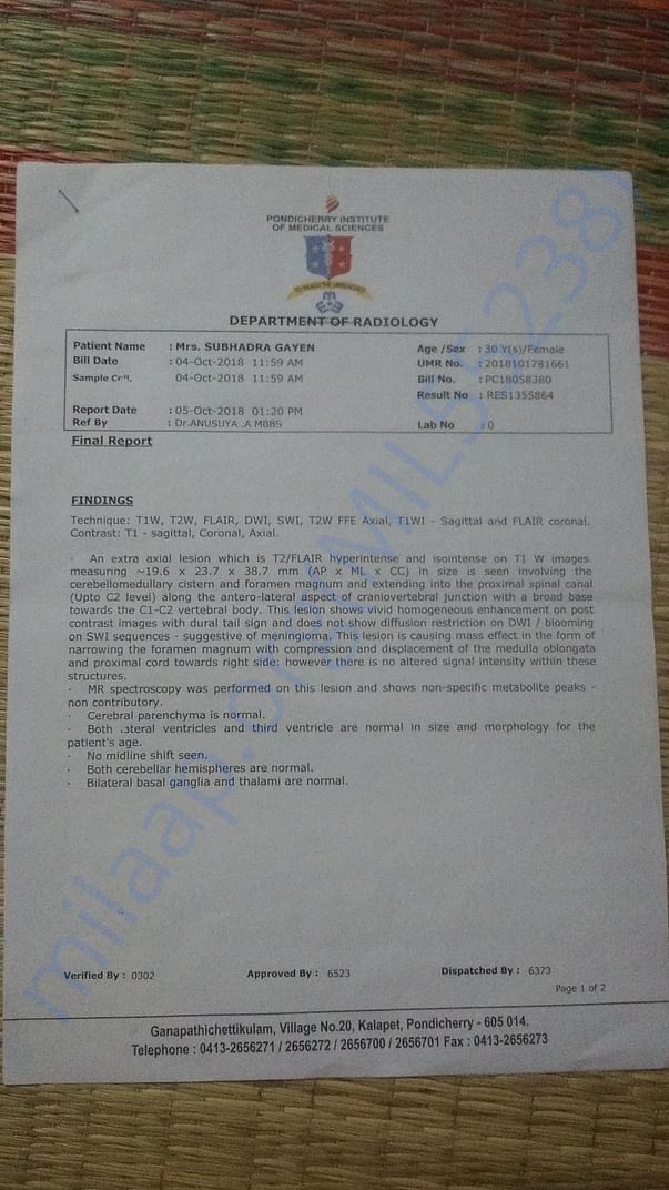CT scan result