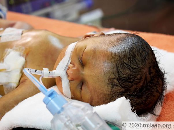 12-Day-Old Baby Girl Who Struggles For Every Breath Needs Urgent Help