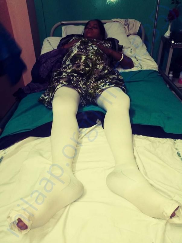 Treatment for paralyzed legs