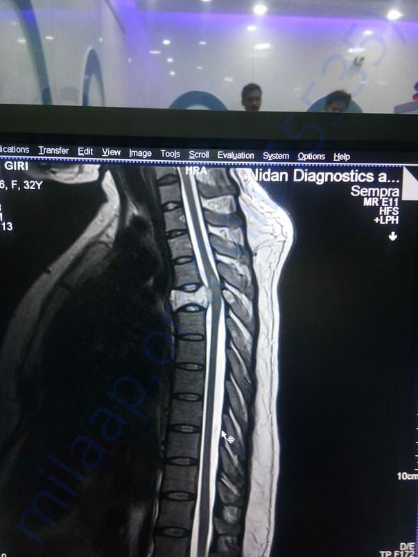 MRI scan report