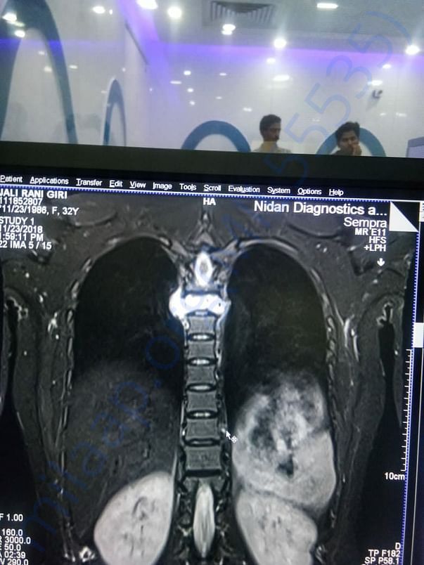 MRI report 2