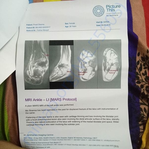 x-ray