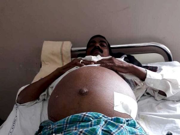 Please Help Me Raise Funds For My Father's Liver Transplantation