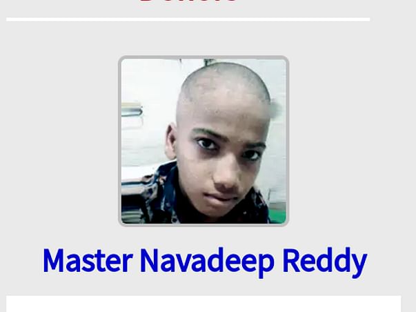 Farmers kid suffering from bone cancer need urgent help to save life