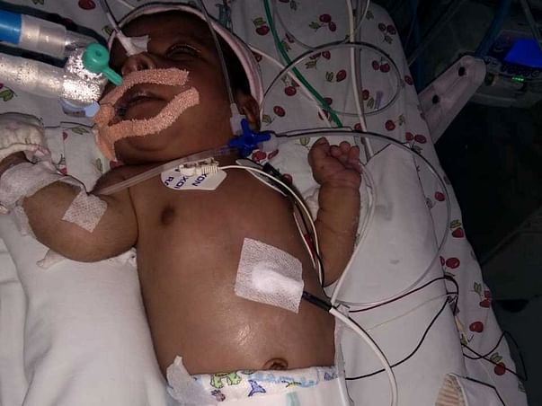 Help My Baby Undergo Heart Surgery