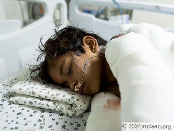 This Girl's Whole Body Got Burnt While Bursting Crackers, Needs Help
