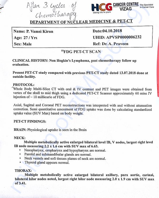 Pet scan