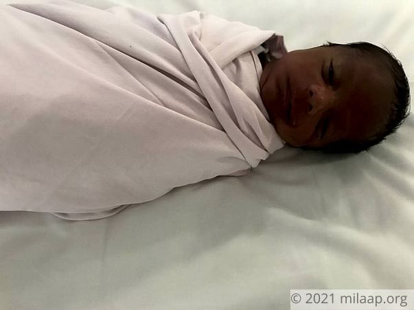 1-Month Old Born After Long Wait Will Turn Blind, Needs Urgent Help
