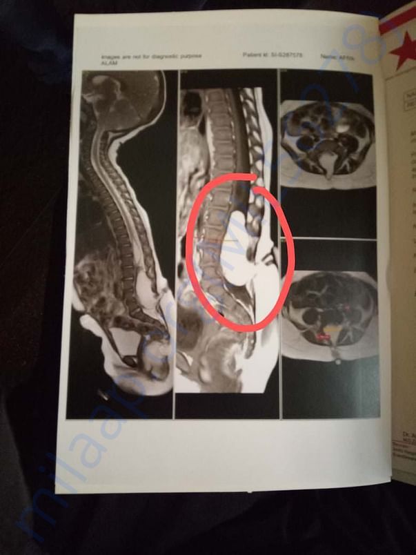 XRAY