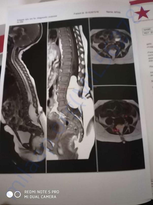 XRAY