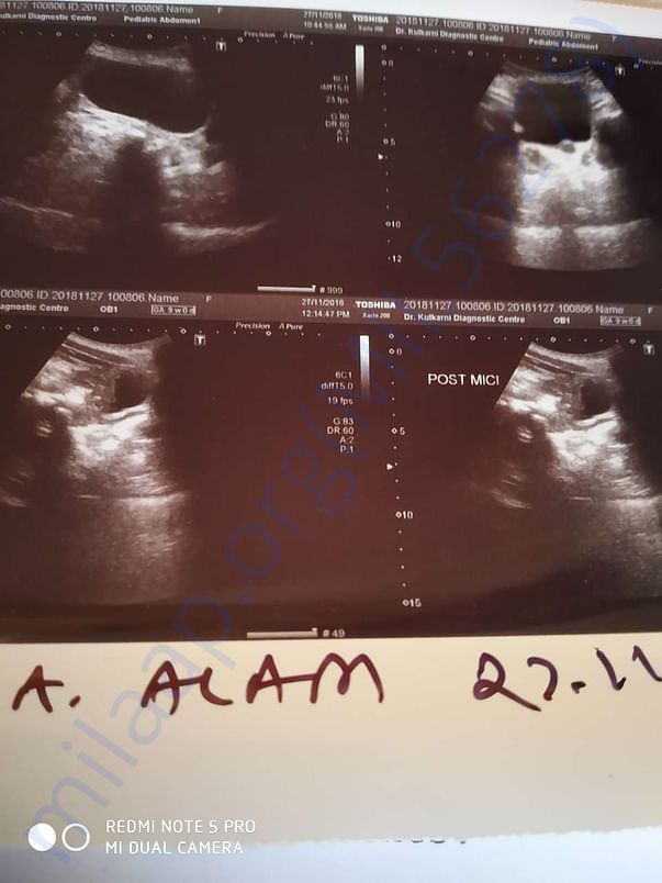 Ultrasound