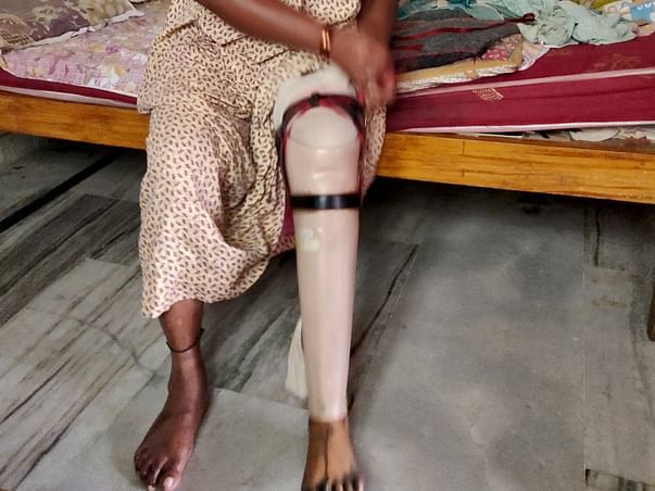 Help My Aunt Get A Flexible Prosthetic Leg