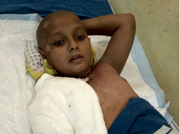 Help Rehan Who Met With An Bus Accident