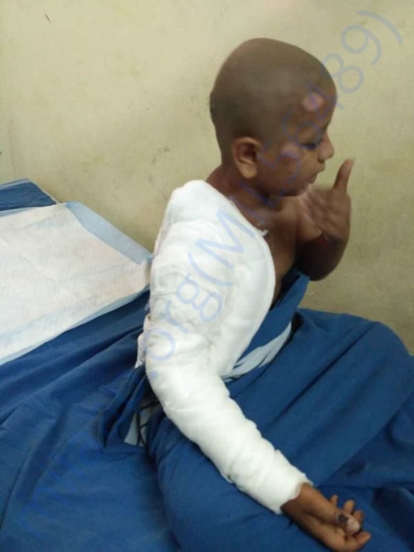 Rehan surgery pics