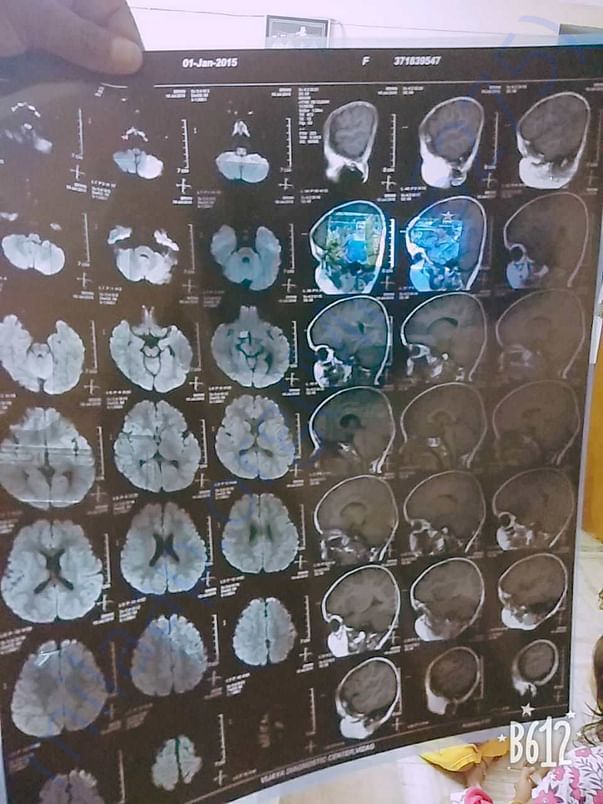 Skull Scans to anslyse