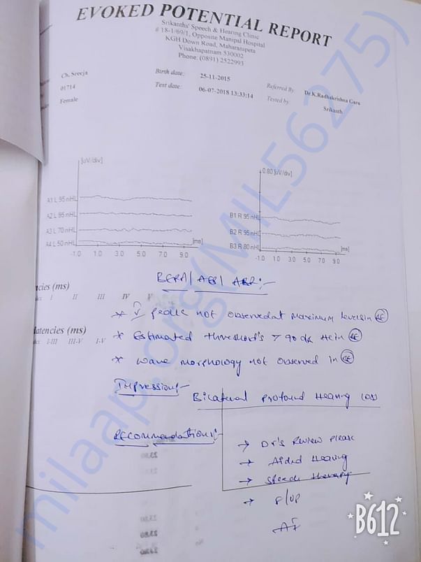 Deafness analysis