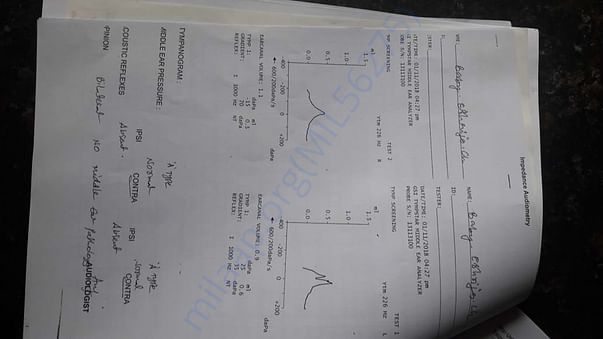 Audiometry test report