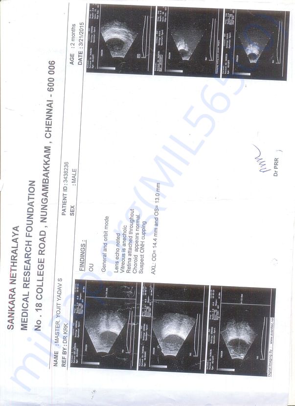 scan