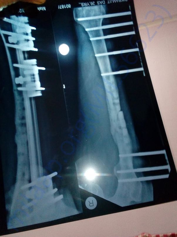 Xray and precsiption