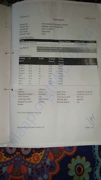 TB report