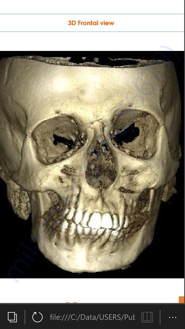 3D Frontal view of face