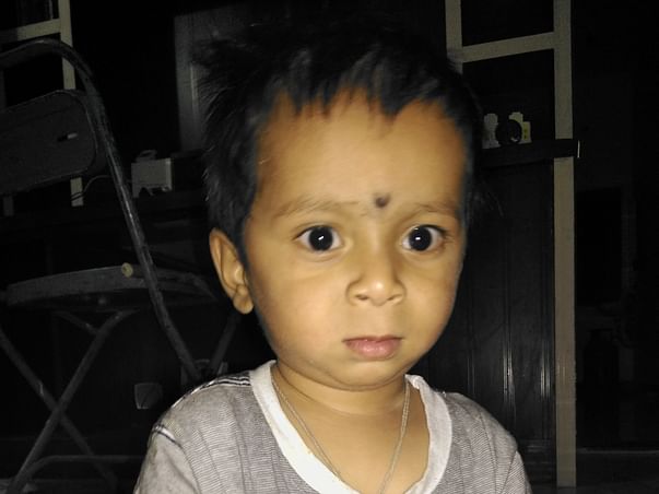 Help My Son Undergo Surgery for Cochlear Implantation