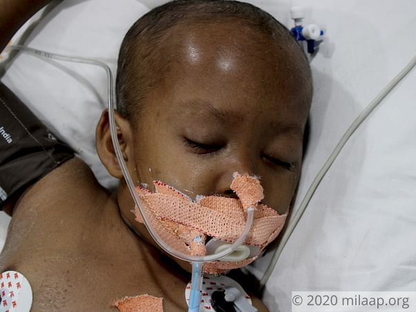 Partially Blind 5-Year-Old Needs ICU Stay To Recover From Infections