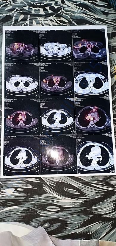 X- rays of the patient