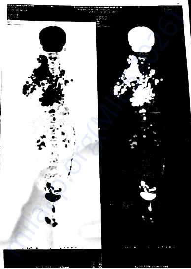 Scan