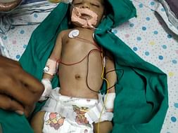 Help New Born Baby For Congenital Heart Disease
