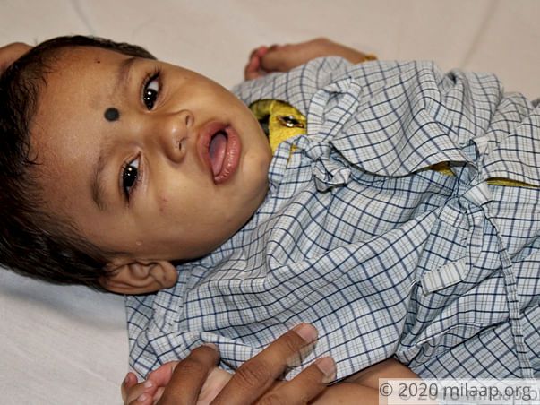Baby Satvika needs your help to undergo treatment