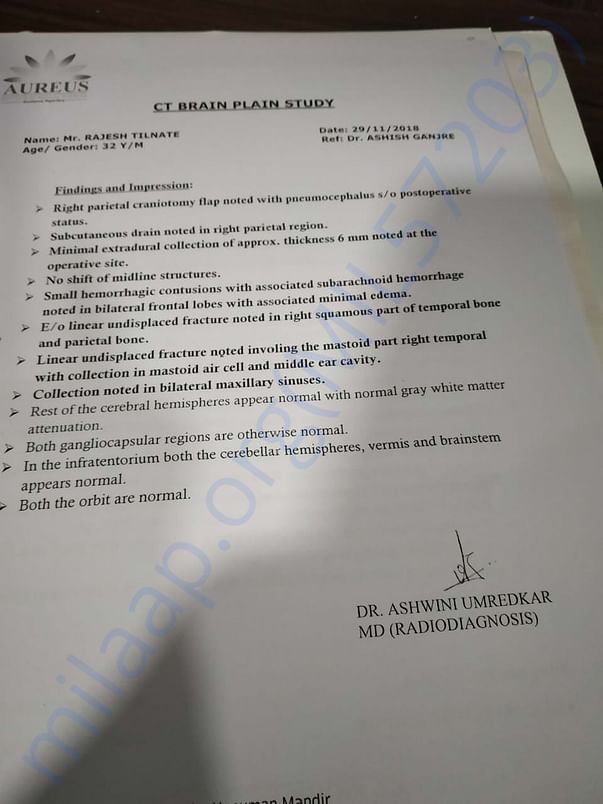 Brain Study Report