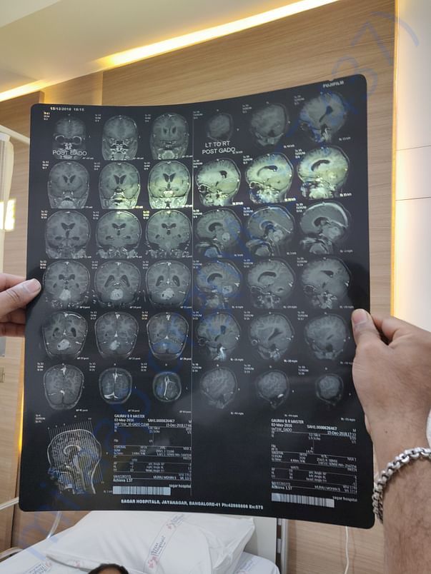 Mri