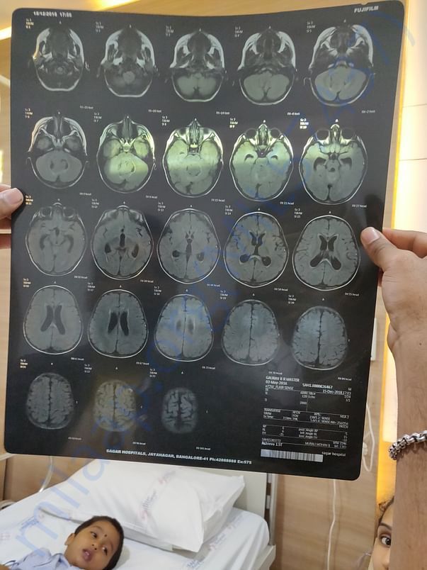 MRI