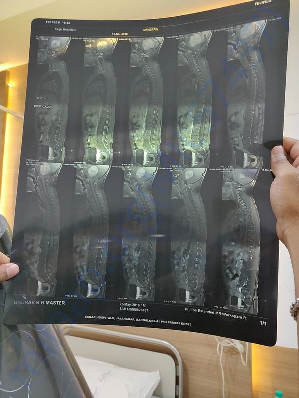 Mri