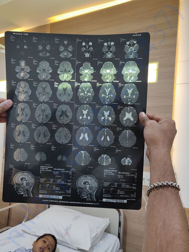 Mri