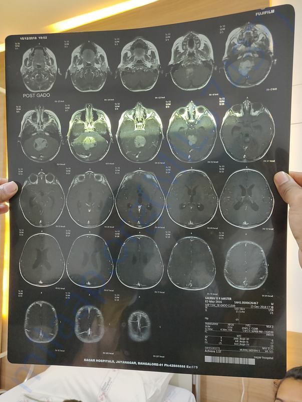 Mri