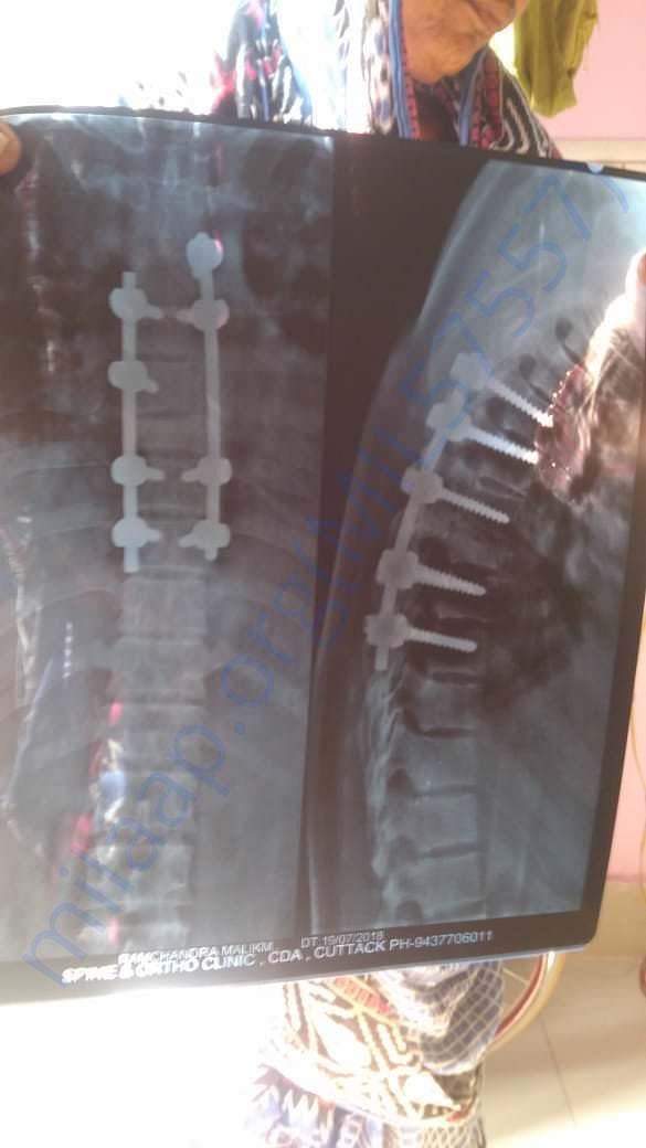 Spinal Code