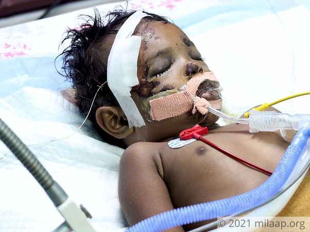 Help 2-Year-Old Who Met With An Accident On Her Way To The Nursery