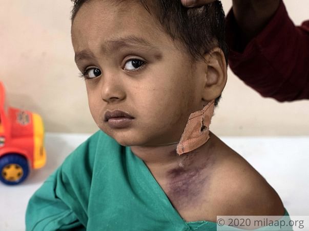 2-Year-Old's Parents Can't Afford The Only Cure For His Rare Disease