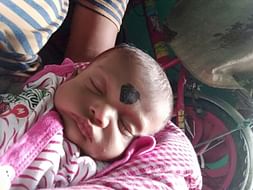 Help Bhaskar Baby's Undergo A Heart Operation