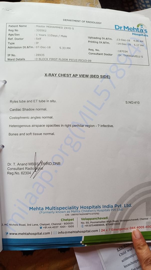 X ray detail